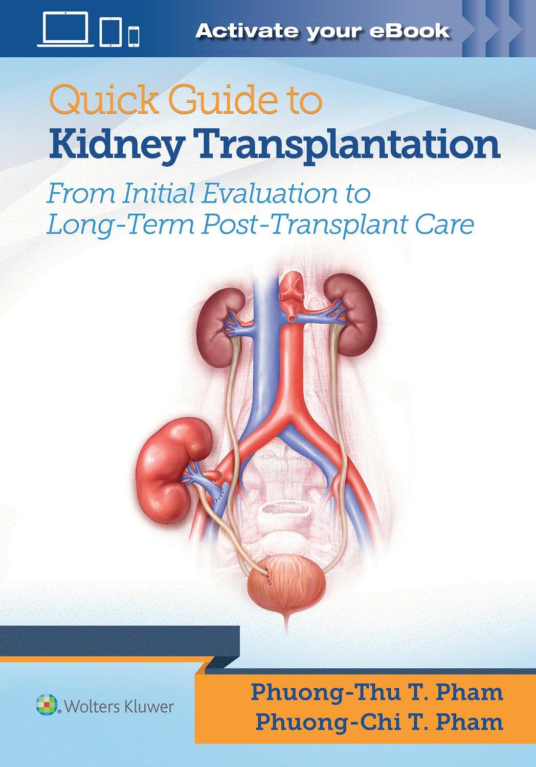Cover: 9781496399649 | Quick Guide to Kidney Transplantation | Pham (u. a.) | Taschenbuch