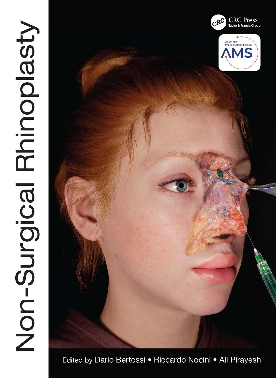 Cover: 9781032303444 | Non-Surgical Rhinoplasty | Ali Pirayesh (u. a.) | Buch | Englisch