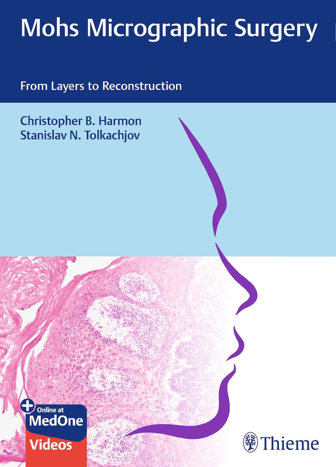 Cover: 9783132420175 | Mohs Micrographic Surgery: From Layers to Reconstruction | Bundle