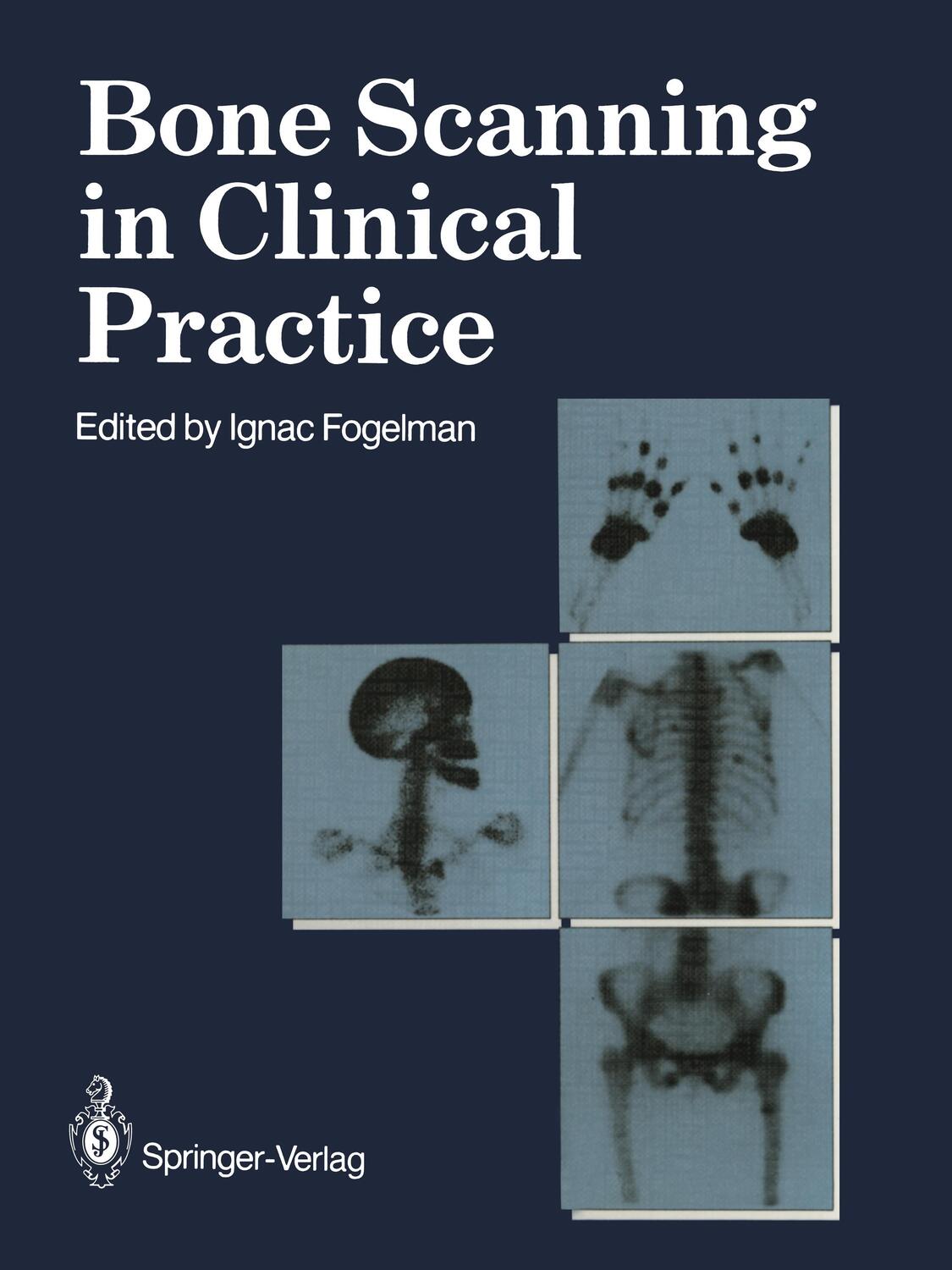 Cover: 9781447114093 | Bone Scanning in Clinical Practice | Ignac Fogelman | Taschenbuch