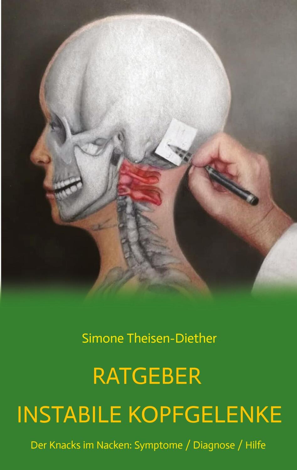 Cover: 9783347704398 | Ratgeber Instabile Kopfgelenke | Simone Theisen-Diether | Taschenbuch