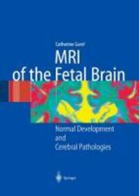 Cover: 9783642622755 | MRI of the Fetal Brain | Normal Development and Cerebral Pathologies