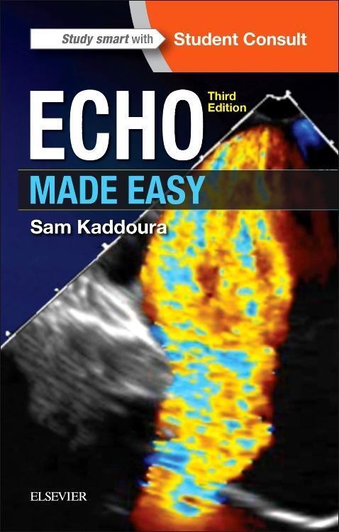 Cover: 9780702066566 | Echo Made Easy | Sam Kaddoura | Taschenbuch | Made Easy | Englisch
