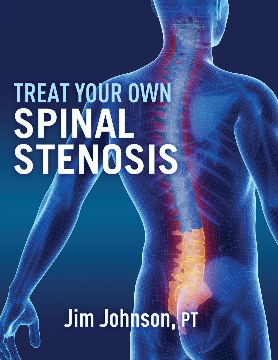 Cover: 9781642379587 | Treat Your Own Spinal Stenosis | Jim Johnson | Taschenbuch | Paperback