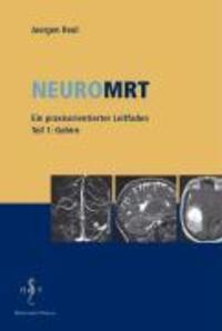 Cover: 9783936817249 | NeuroMRT 1 | Gehirn. Ein praxisorientierter Leitfaden | Juergen Reul