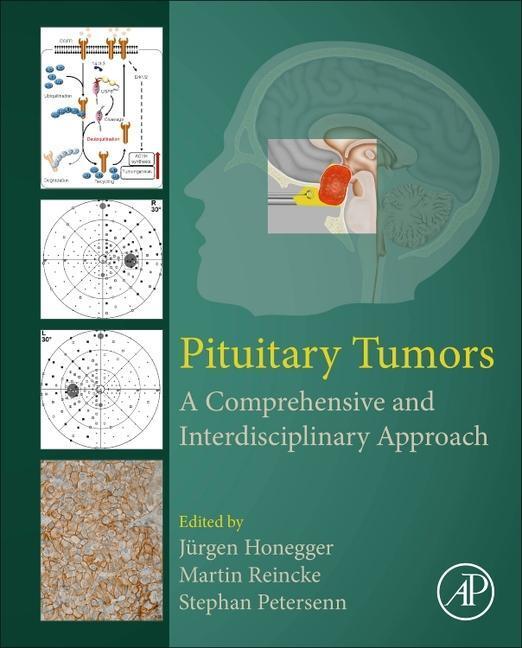 Cover: 9780128199497 | Pituitary Tumors | A Comprehensive and Interdisciplinary Approach