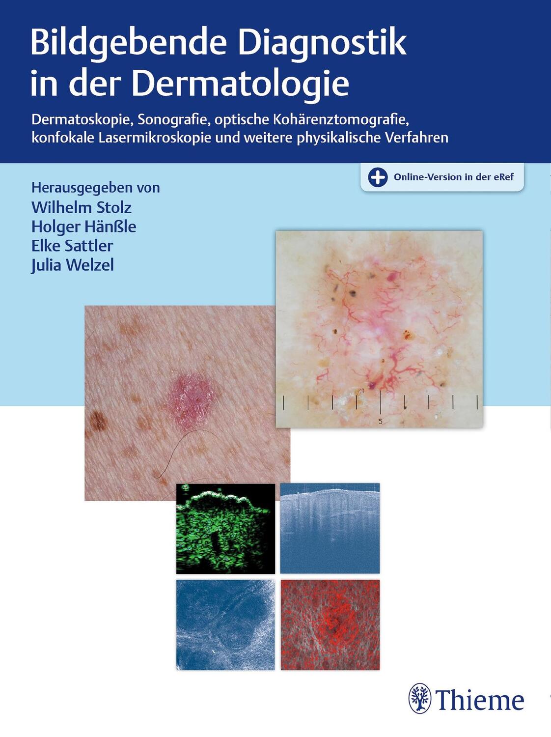 Cover: 9783132402362 | Bildgebende Diagnostik in der Dermatologie | Wilhelm Stolz (u. a.)