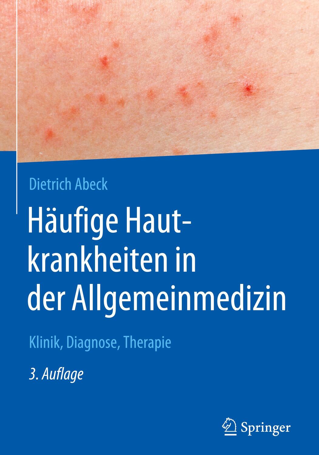 Cover: 9783662574461 | Häufige Hautkrankheiten in der Allgemeinmedizin | Dietrich Abeck
