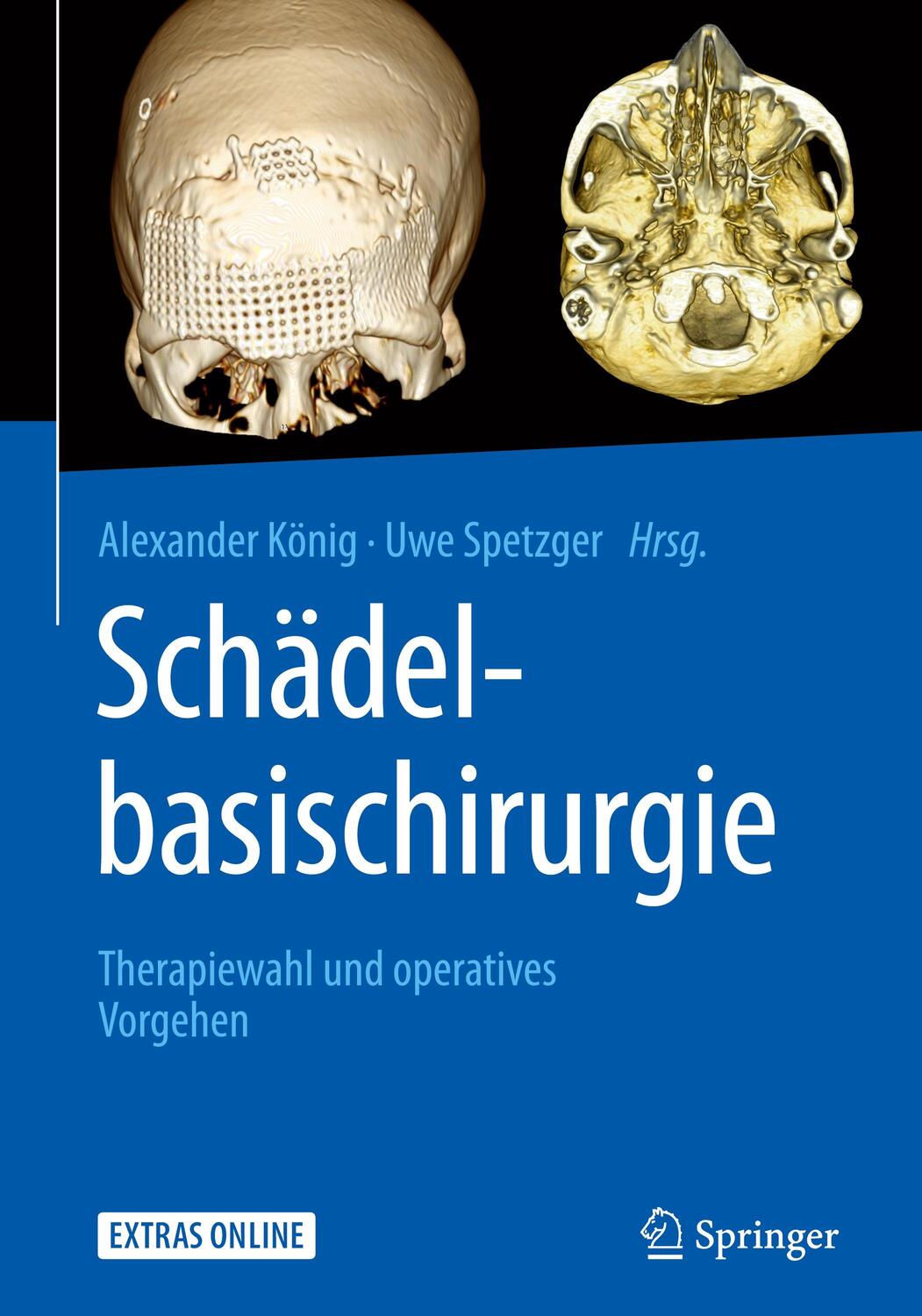 Cover: 9783662546710 | Schädelbasischirurgie | Therapiewahl und operatives Vorgehen | Buch