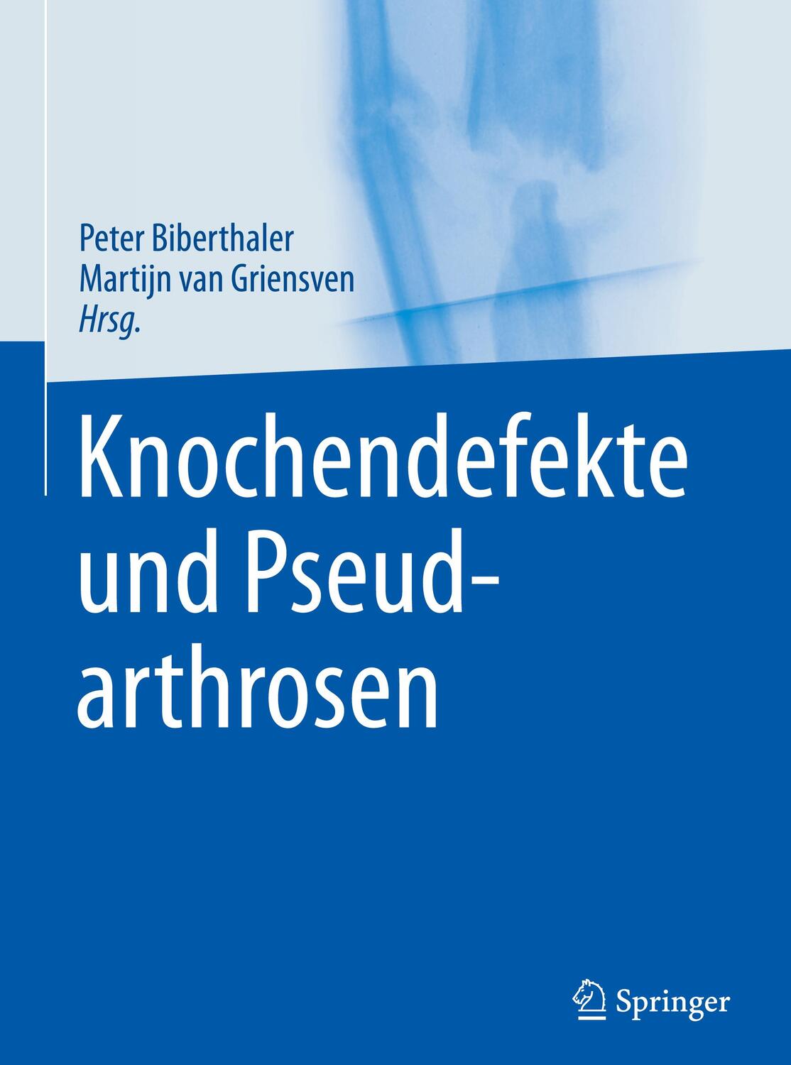 Cover: 9783642449901 | Knochendefekte und Pseudarthrosen | Martijn van Griensven (u. a.)