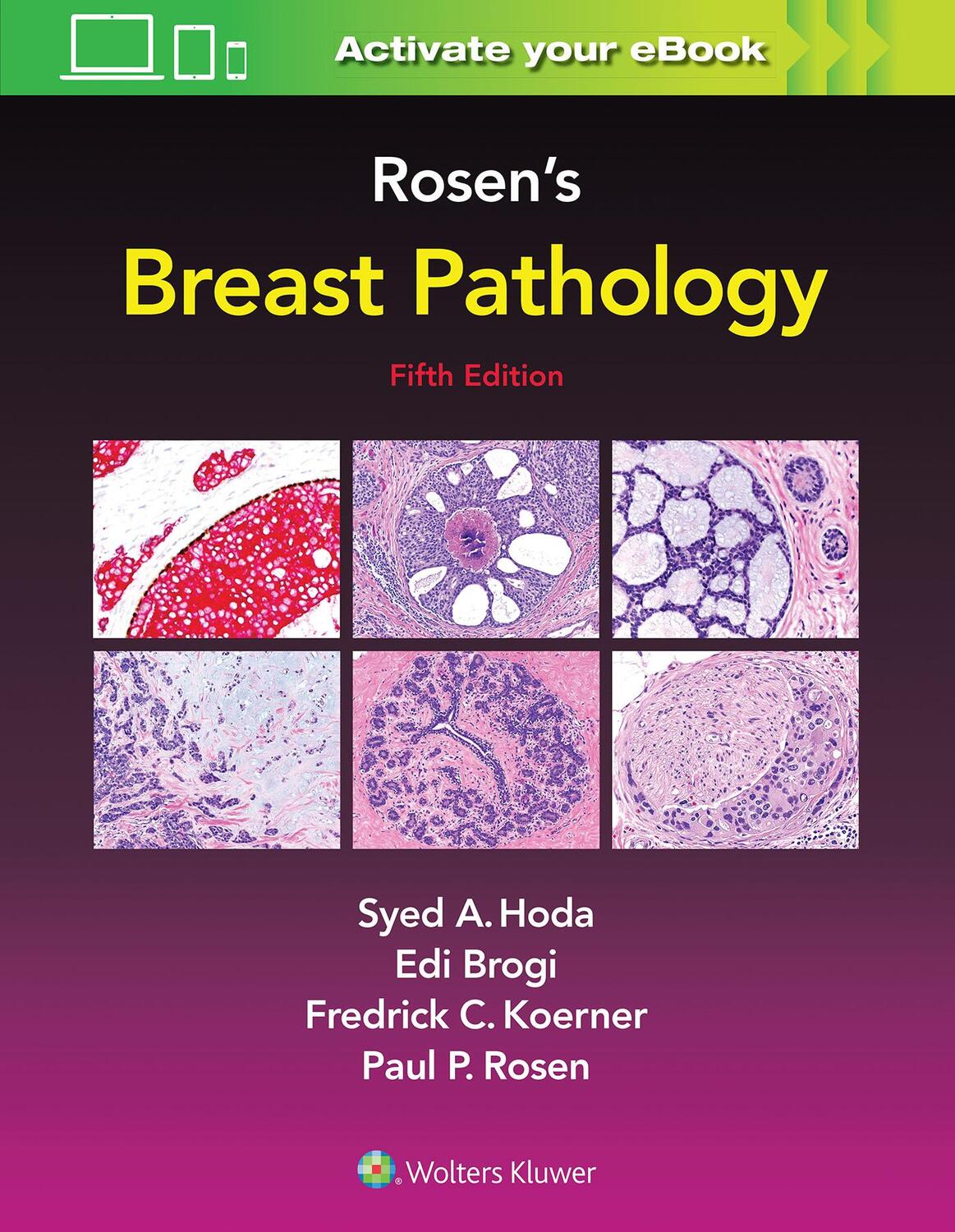 Cover: 9781496398918 | Rosen's Breast Pathology | Syed A. Hoda (u. a.) | Buch | Gebunden