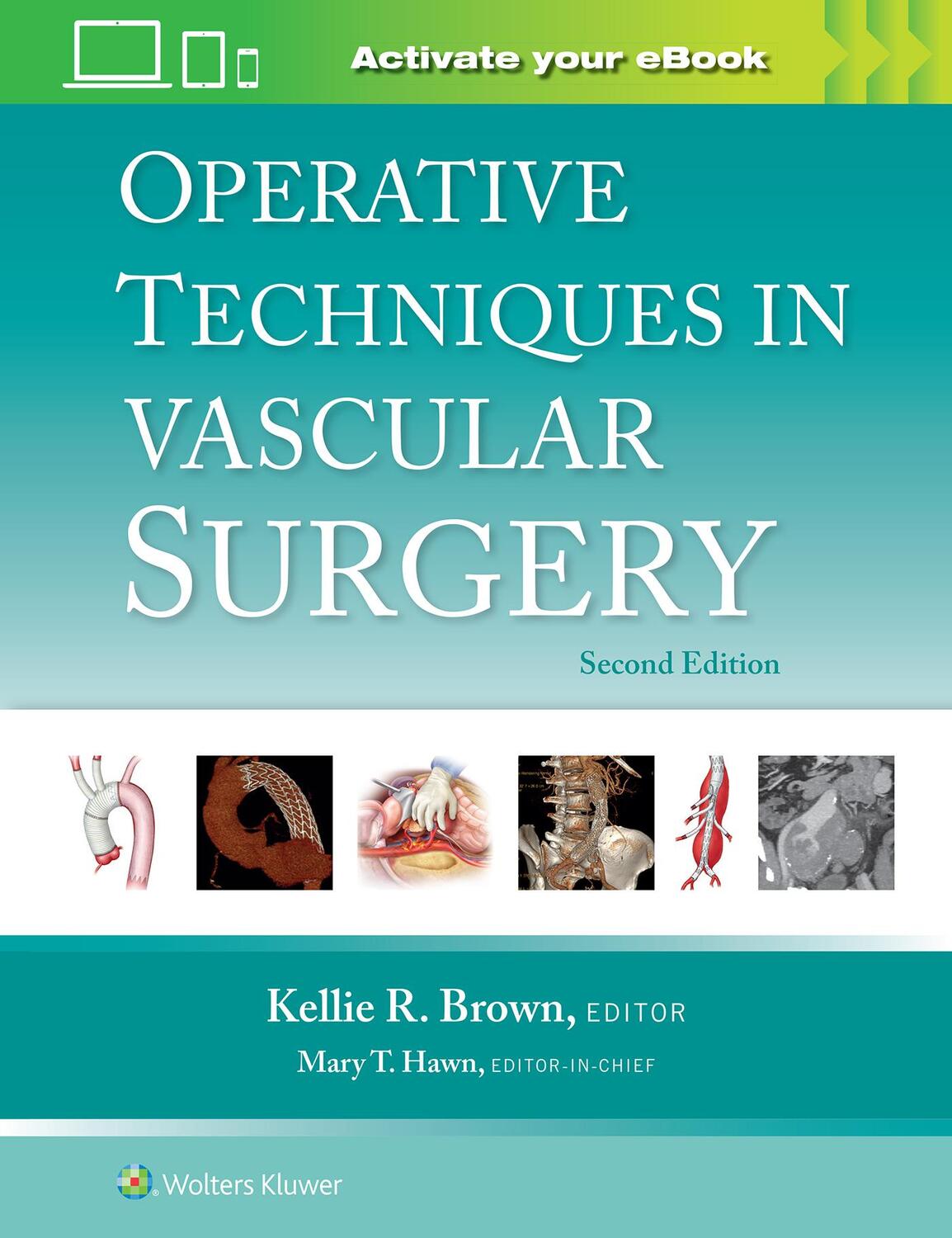 Cover: 9781975176648 | Operative Techniques in Vascular Surgery: Print + eBook with...