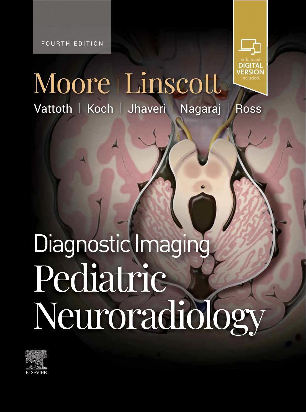 Cover: 9780443234927 | Diagnostic Imaging: Pediatric Neuroradiology | Kevin R Moore (u. a.)