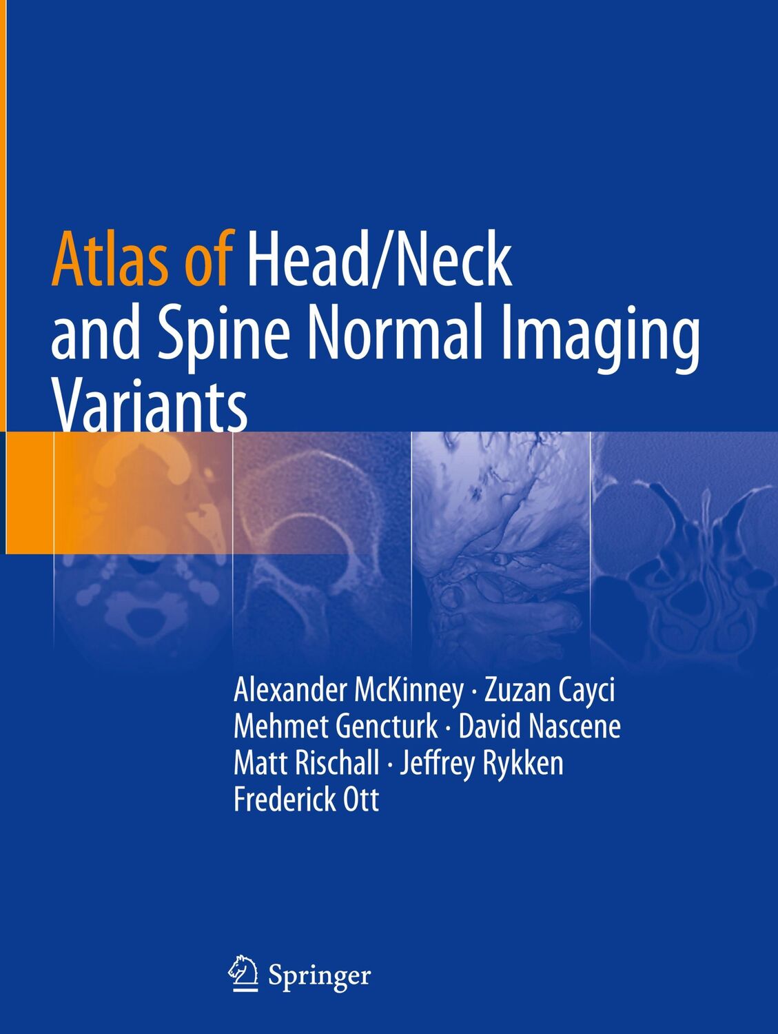 Cover: 9783319954400 | Atlas of Head/Neck and Spine Normal Imaging Variants | Buch | xiii