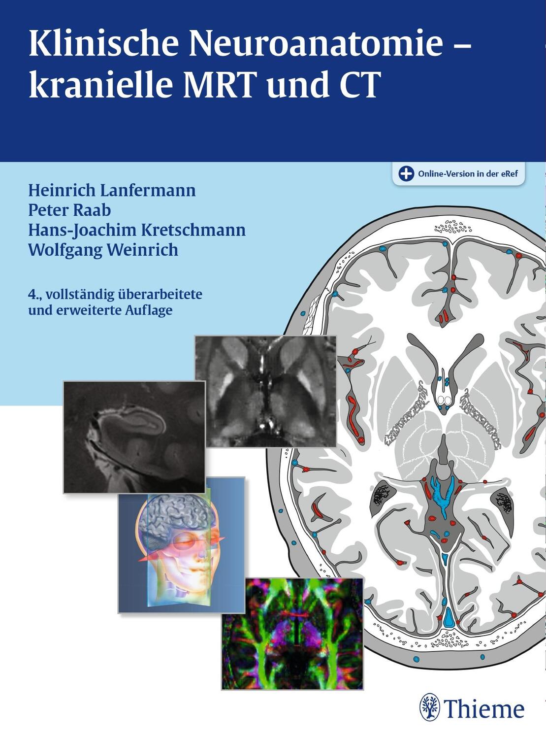 Cover: 9783136152041 | Klinische Neuroanatomie - kranielle MRT und CT | Lanfermann (u. a.)