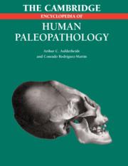 Cover: 9781107403772 | The Cambridge Encyclopedia of Human Paleopathology | Taschenbuch