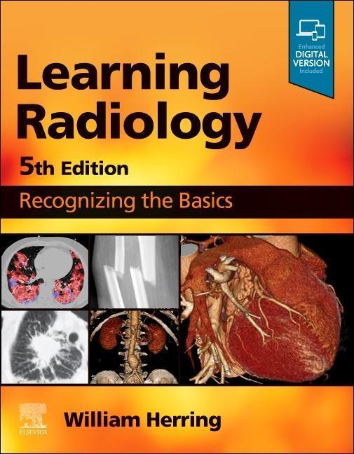 Cover: 9780323878173 | Learning Radiology | Recognizing the Basics | William Herring | Buch
