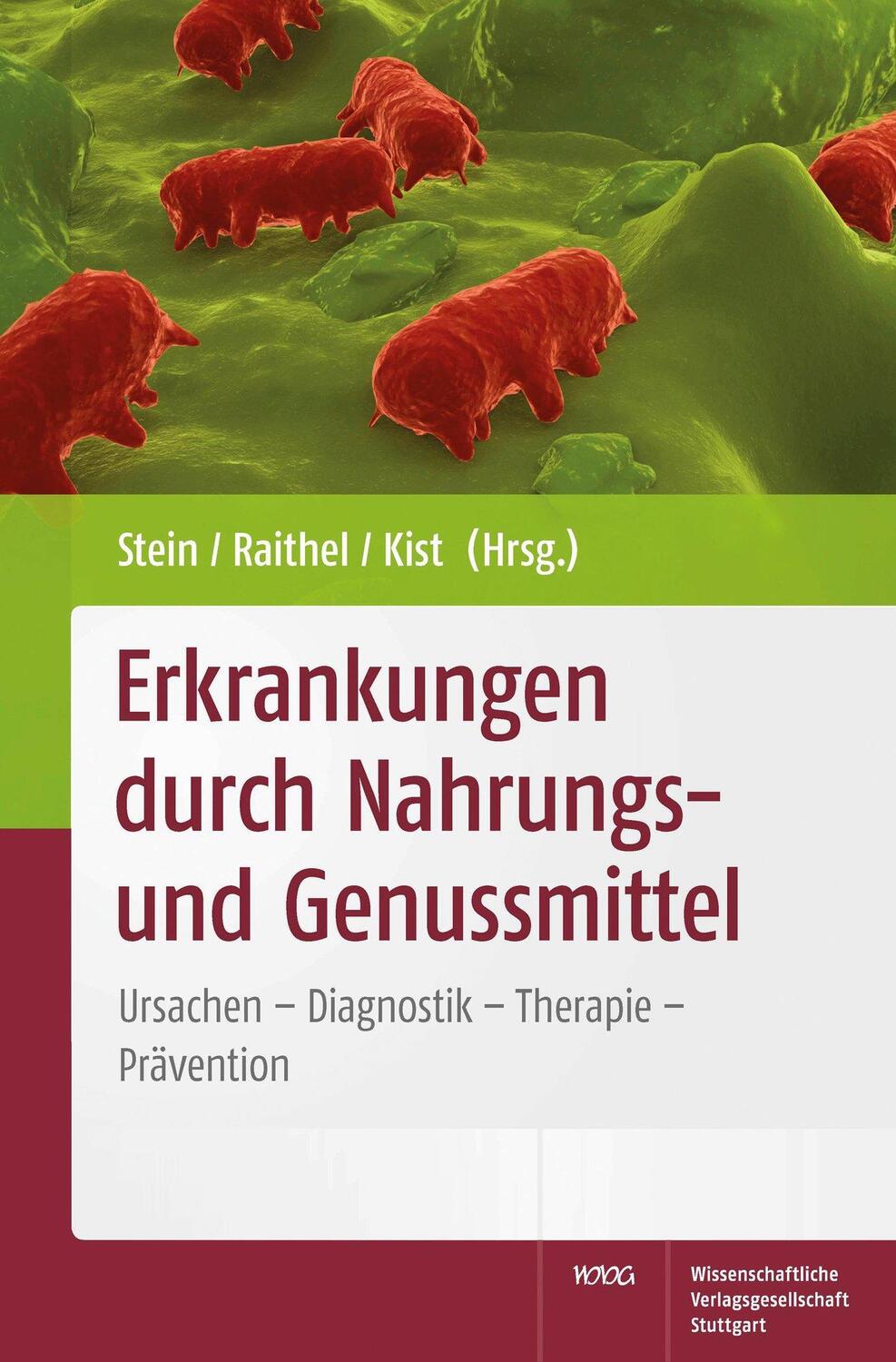 Cover: 9783804725652 | Erkrankungen durch Nahrungs- und Genussmittel | Jürgen Stein (u. a.)