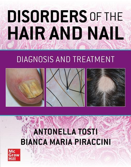 Cover: 9781260462470 | Disorders of the Hair and Nail: Diagnosis and Treatment | Buch | 2023