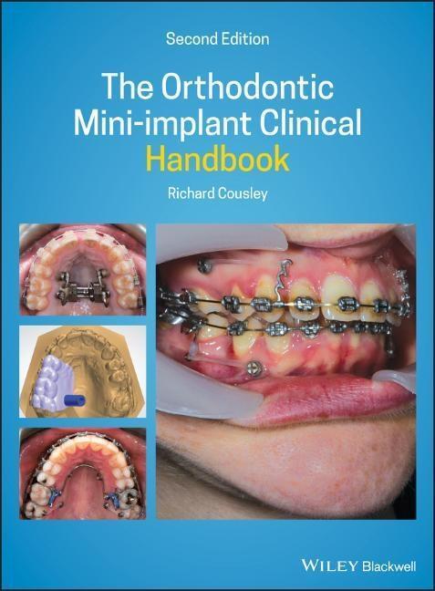Cover: 9781119509752 | The Orthodontic Mini-Implant Clinical Handbook | Richard Cousley