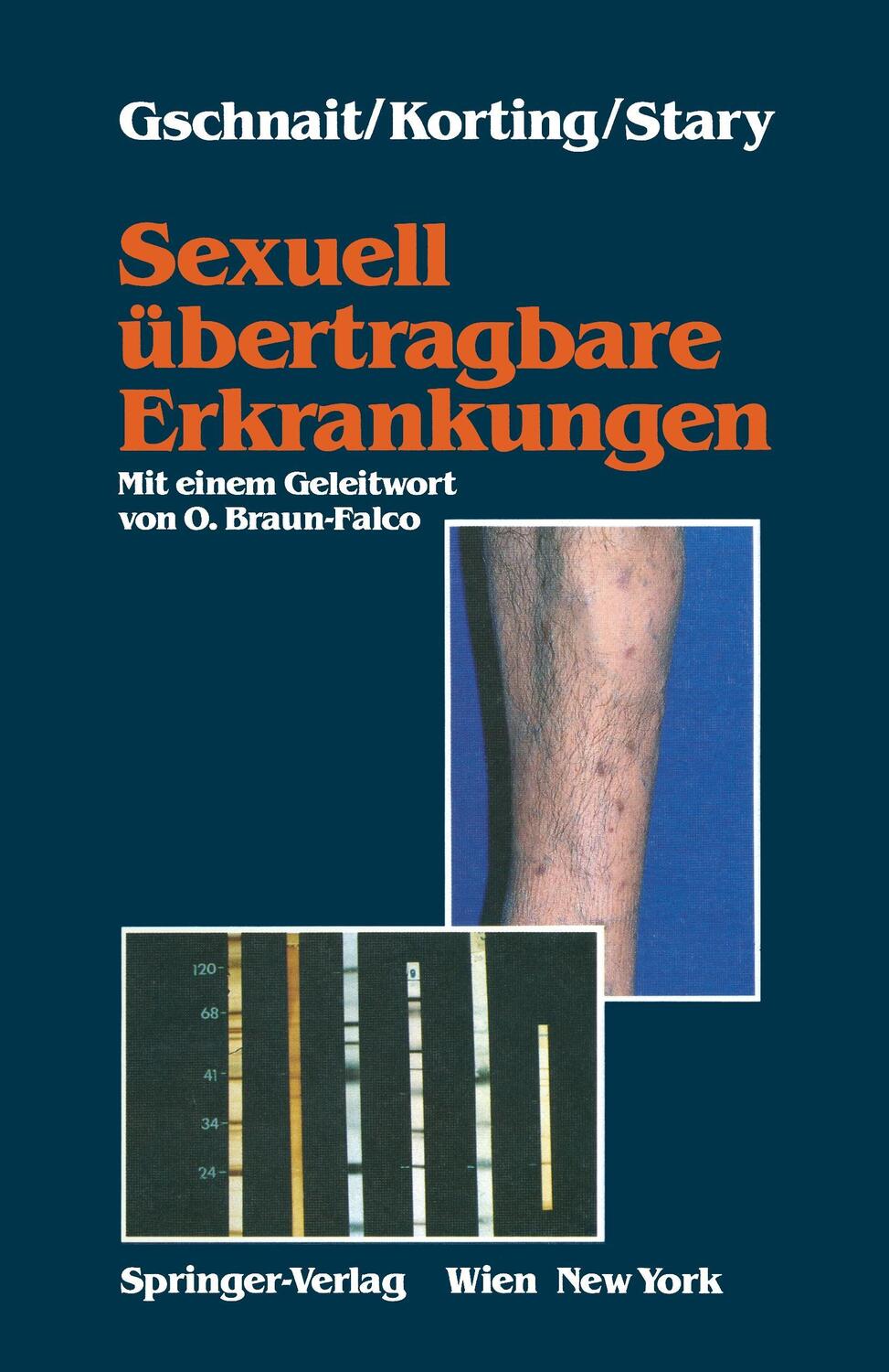 Cover: 9783211821398 | Sexuell übertragbare Erkrankungen | Fritz Gschnait (u. a.) | Buch