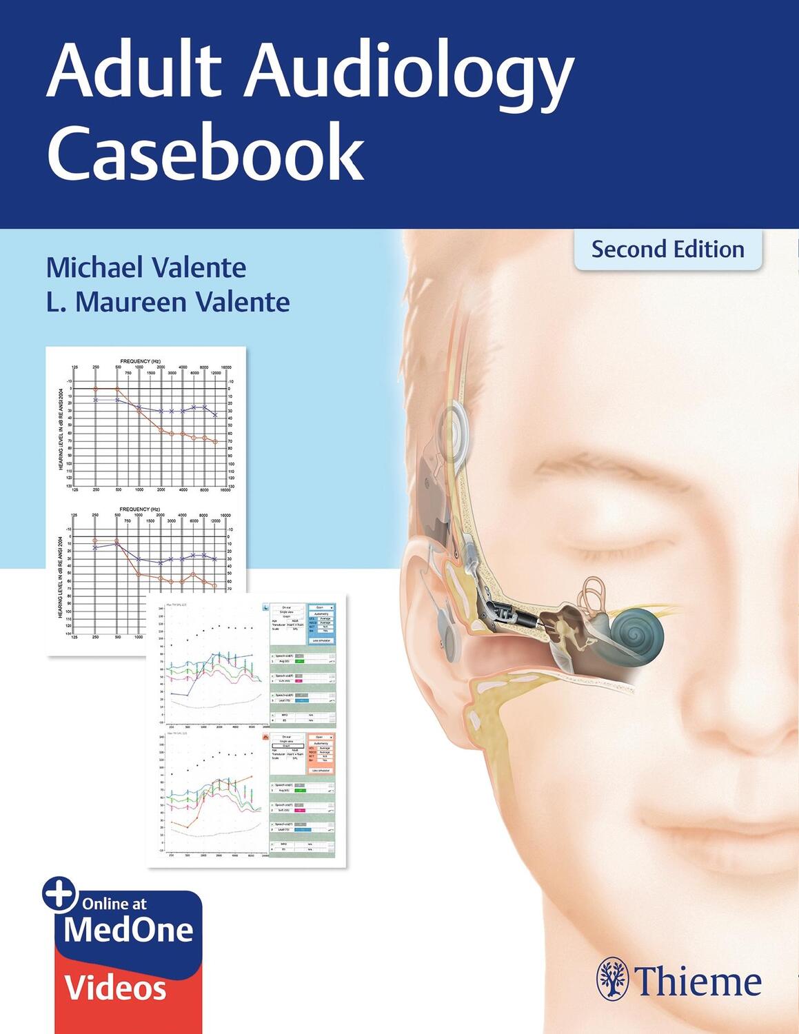 Cover: 9781626237292 | Adult Audiology Casebook | Michael Valente (u. a.) | Taschenbuch