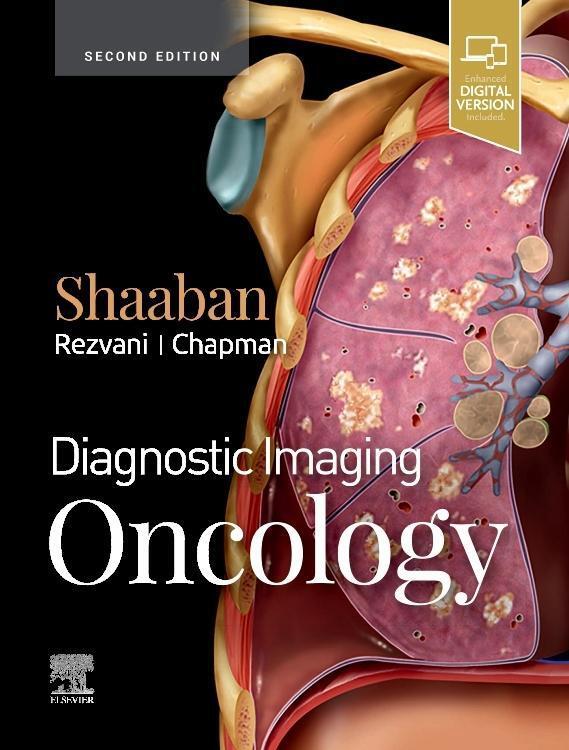Cover: 9780323661126 | Shaaban, A: Diagnostic Imaging: Oncology | Akram M. Shaaban (u. a.)