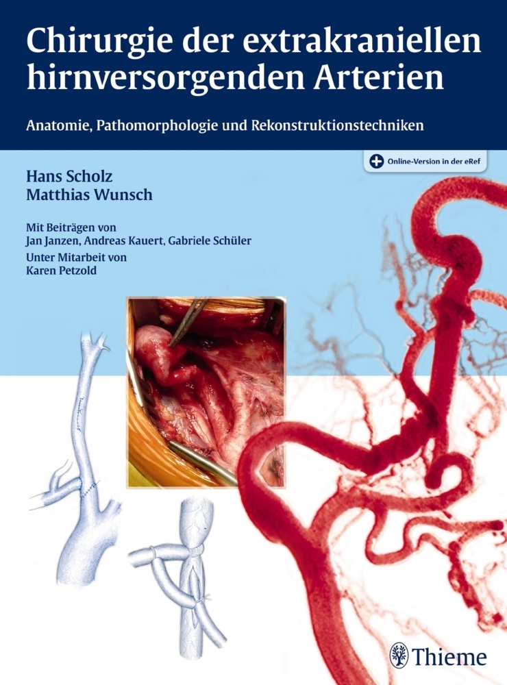 Cover: 9783131772619 | Chirurgie der extrakraniellen hirnversorgenden Arterien | Bundle