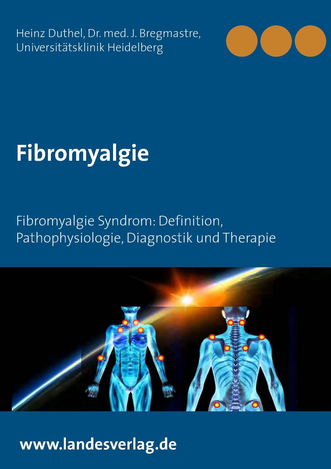 Cover: 9783741293474 | Fibromyalgie | Heinz Duthel | Taschenbuch | Books on Demand