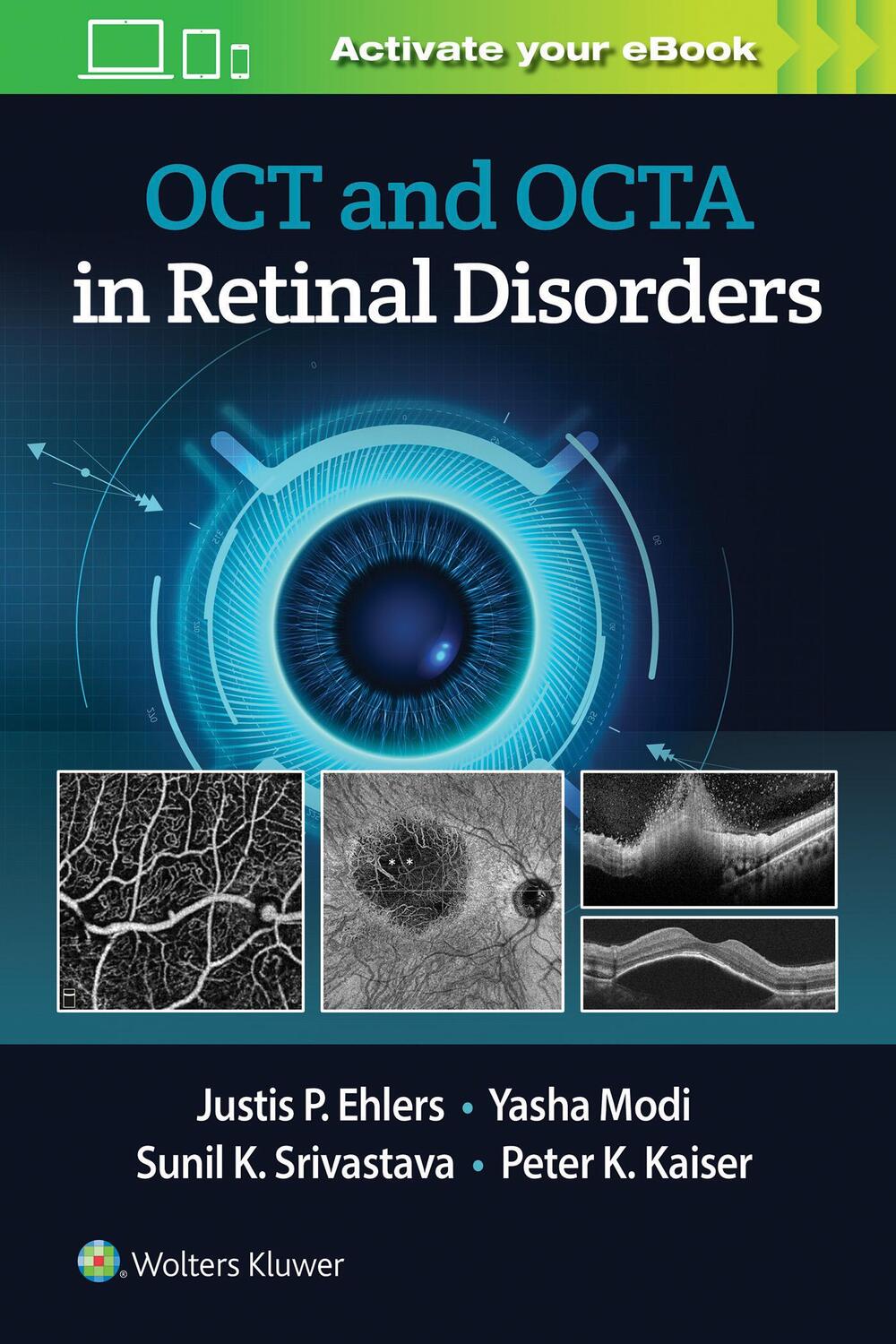 Cover: 9781975144227 | OCT and OCTA in Retinal Disorders | Justis P. Ehlers | Taschenbuch