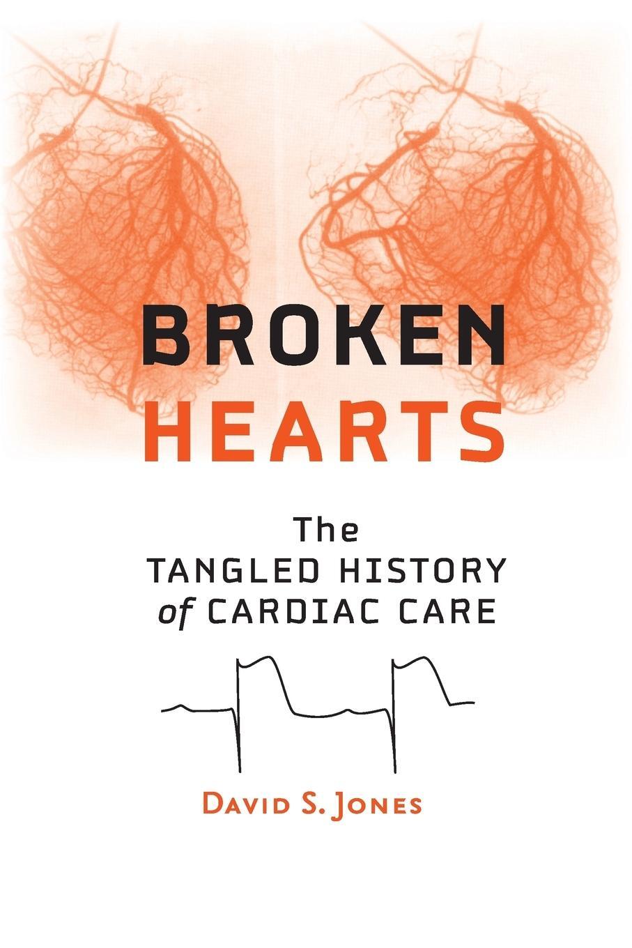Cover: 9781421415758 | Broken Hearts | The Tangled History of Cardiac Care | David S. Jones