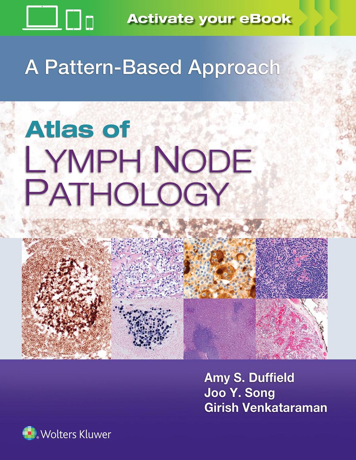 Cover: 9781496375544 | Atlas of Lymph Node Pathology | A Pattern Based Approach | Buch | 2020