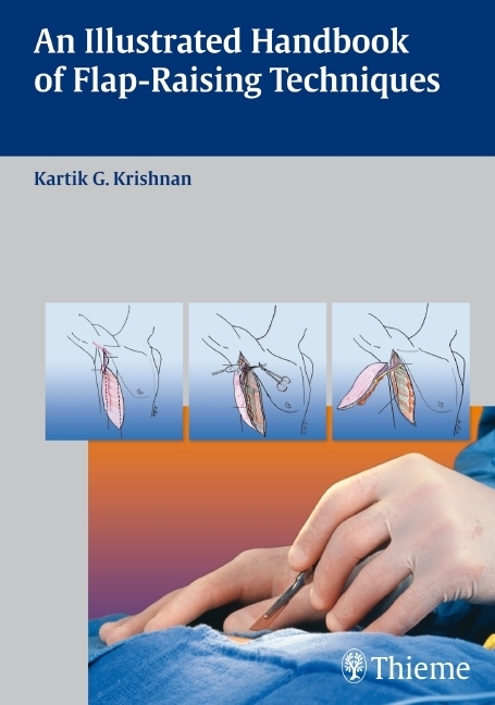 Cover: 9783131477613 | An Illustrated Handbook of Flap-Raising Techniques | Krishnan | Buch