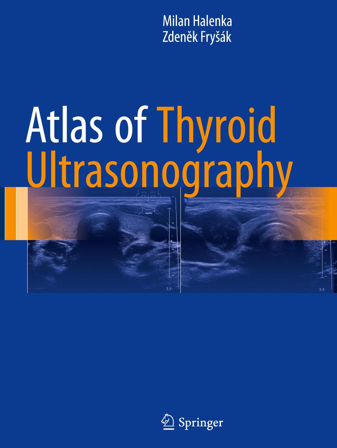 Cover: 9783319537580 | Atlas of Thyroid Ultrasonography | Zden¿k Fry¿ák (u. a.) | Buch | 2017