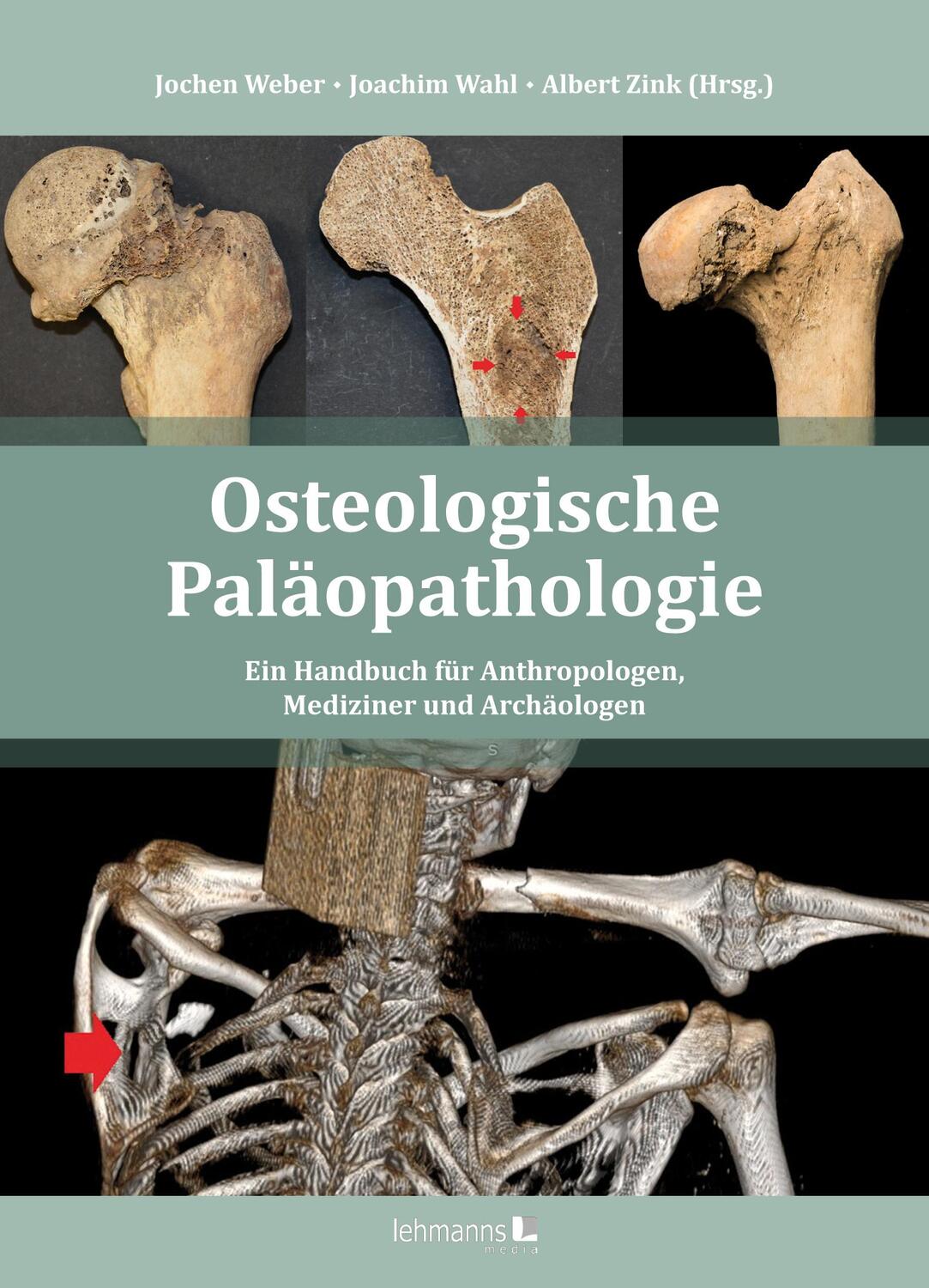 Cover: 9783965433144 | Osteologische Paläopathologie | Jochen Weber (u. a.) | Buch | Deutsch