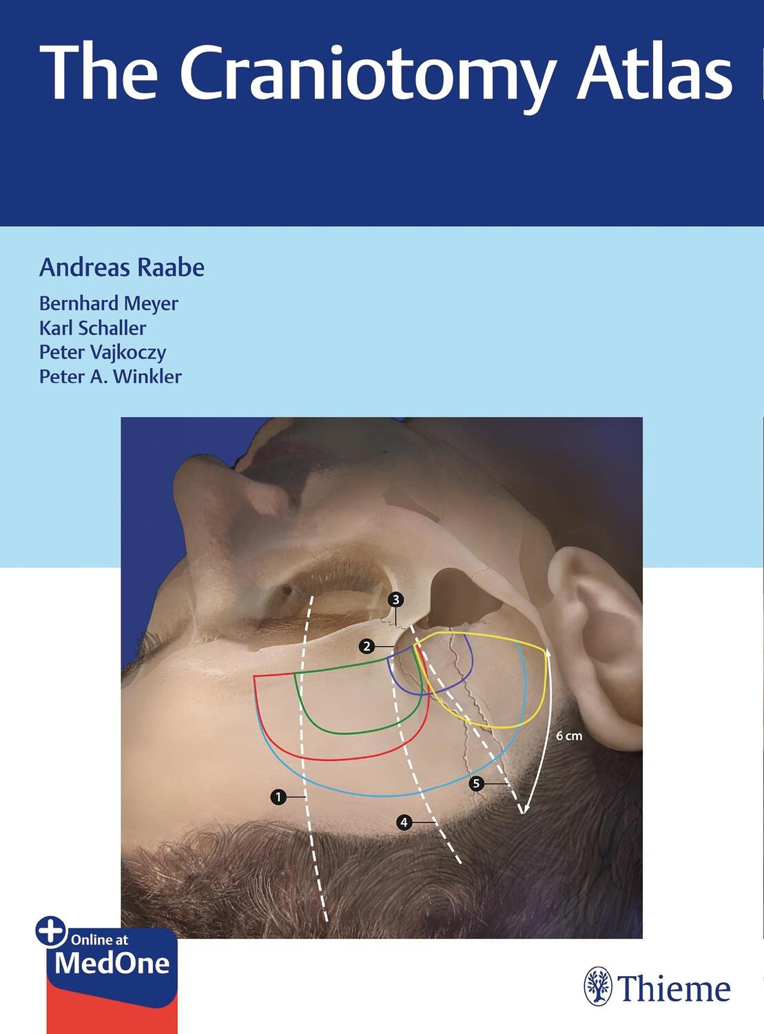 Cover: 9783132057913 | The Craniotomy Atlas | Andreas Raabe | Bundle | Mixed Media Product