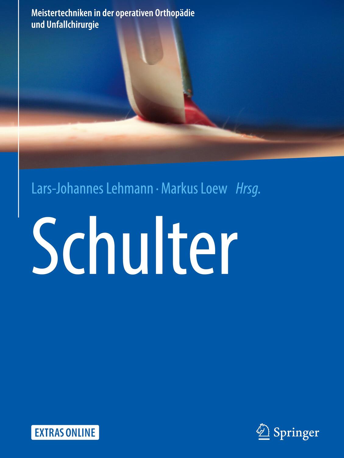 Cover: 9783662547458 | Schulter | Markus Loew (u. a.) | Buch | HC runder Rücken kaschiert