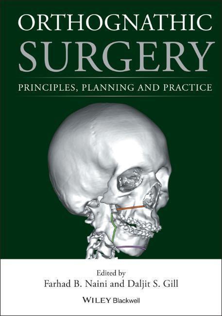 Cover: 9781118649978 | Orthognathic Surgery | Principles, Planning and Practice | Buch | 2017