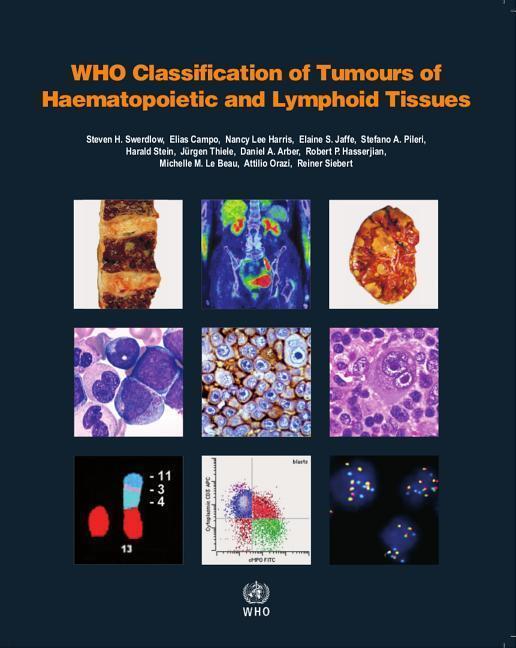 Cover: 9789283244943 | WHO Classification of Tumours of Haematopoietic and Lymphoid Tissues