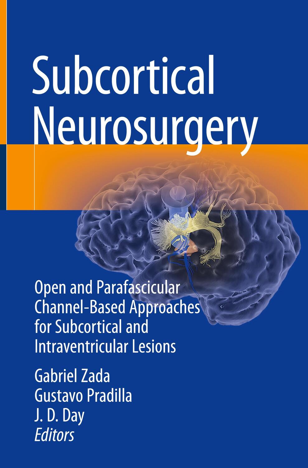 Cover: 9783030951528 | Subcortical Neurosurgery | Gabriel Zada (u. a.) | Buch | XII | 2022