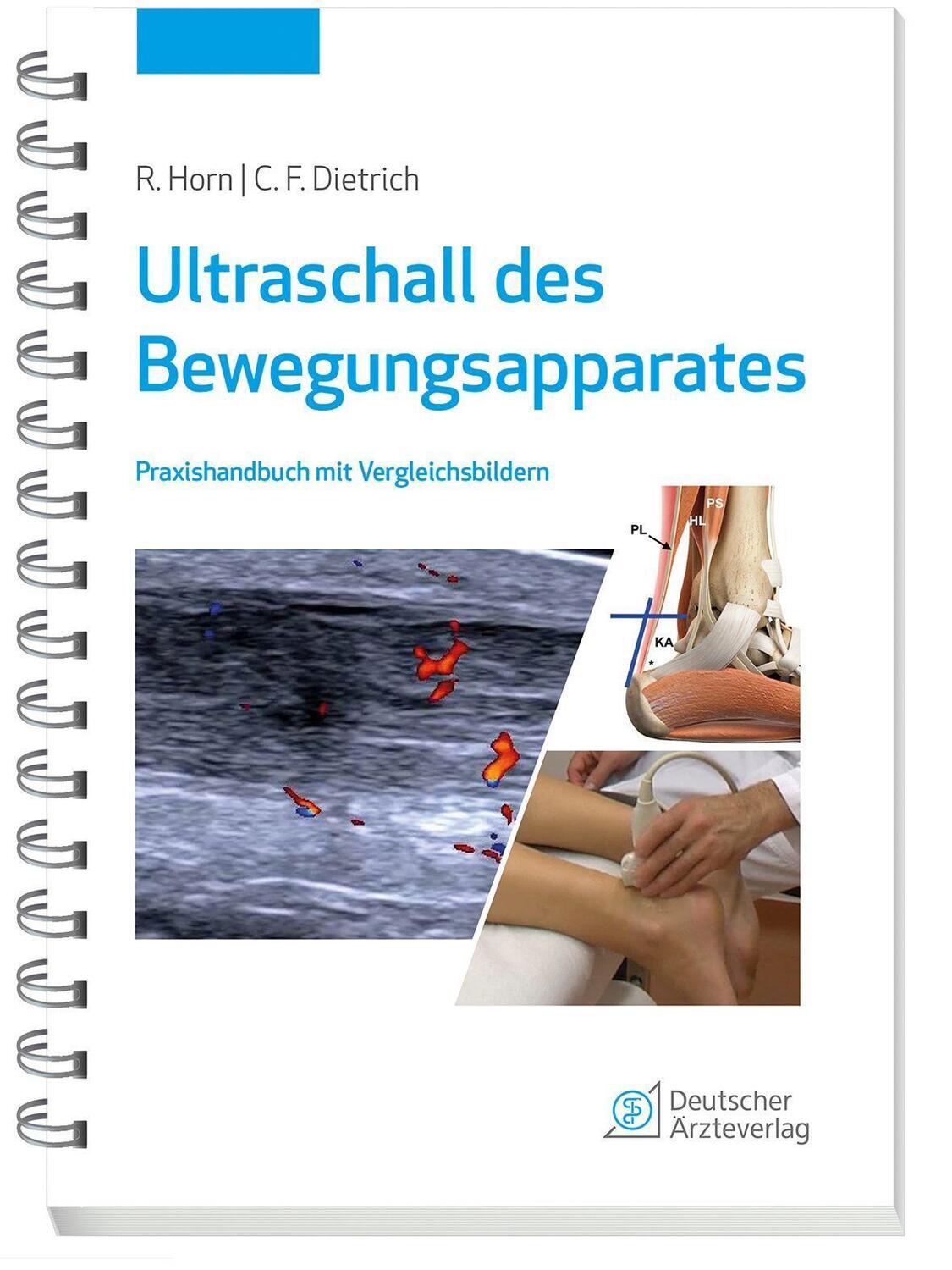 Cover: 9783769137668 | Ultraschall des Bewegungsapparates | Rudolf Horn (u. a.) | Taschenbuch