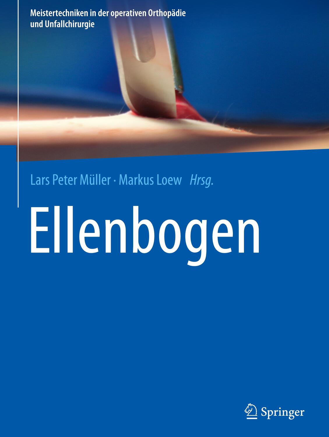 Cover: 9783662629901 | Ellenbogen | Markus Loew (u. a.) | Buch | XI | Deutsch | 2021