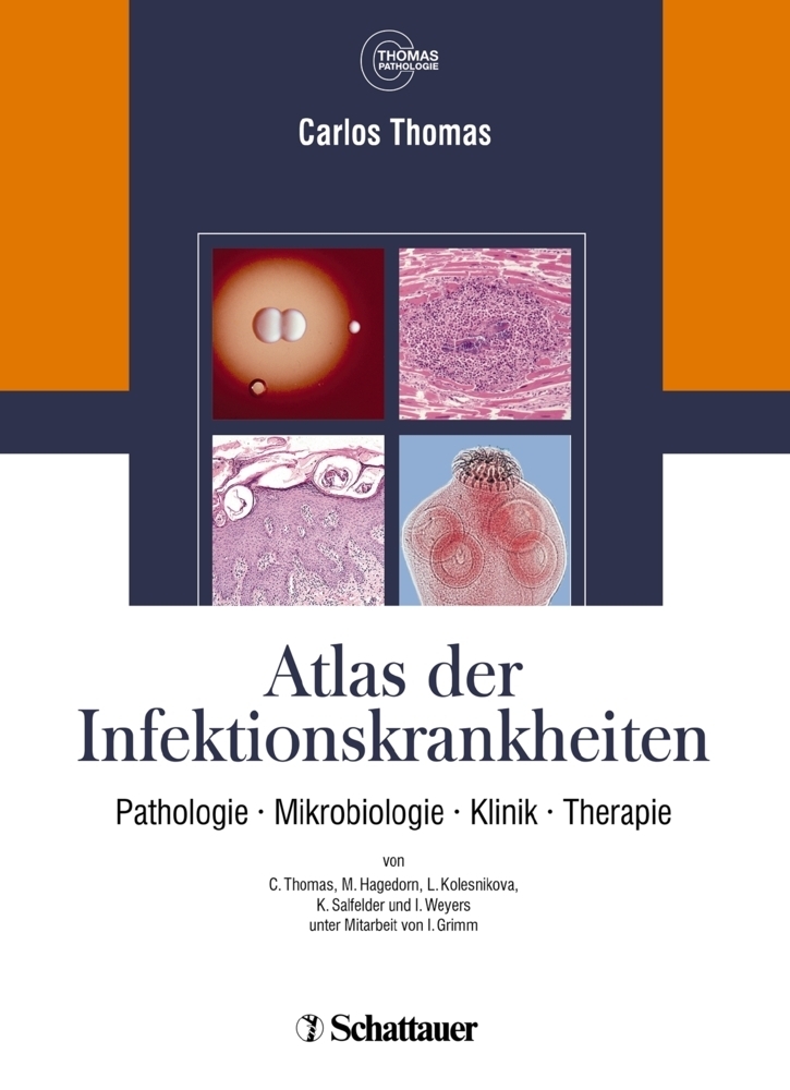 Cover: 9783794527625 | Atlas der Infektionskrankheiten | Carlos Thomas | Taschenbuch | 2010