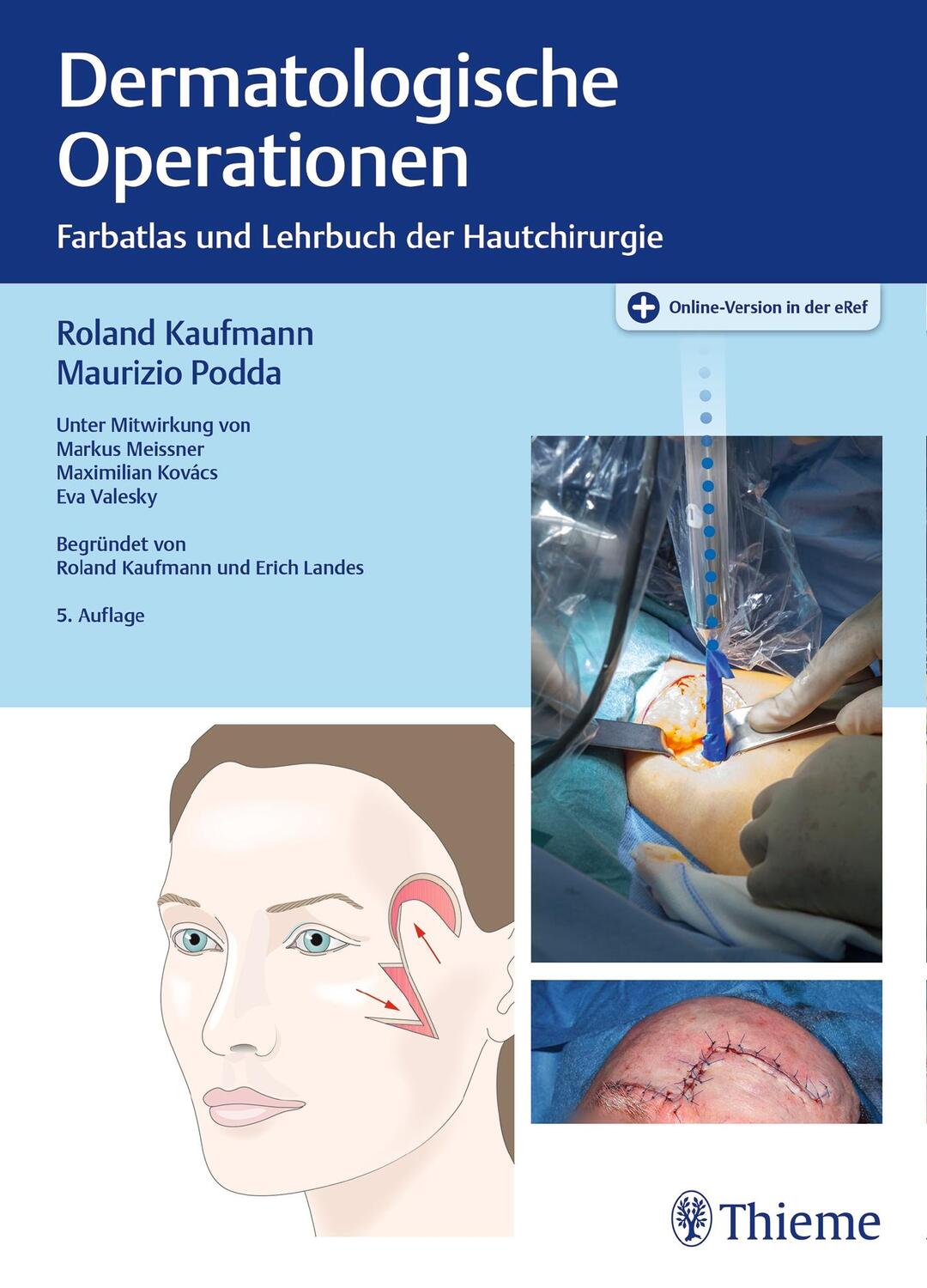 Cover: 9783132412958 | Dermatologische Operationen | Farbatlas und Lehrbuch der Hautchirurgie