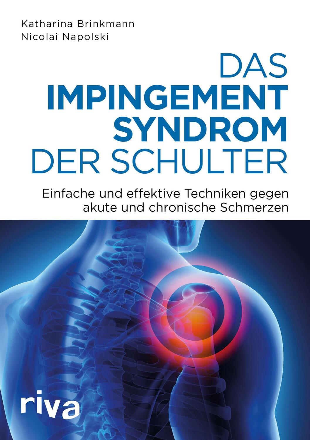 Cover: 9783742305008 | Das Impingement-Syndrom der Schulter | Nicolai Napolski (u. a.) | Buch