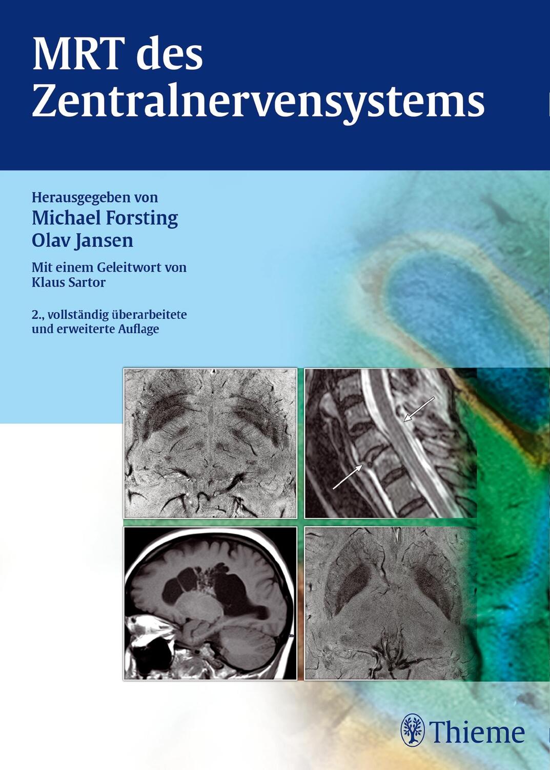 Cover: 9783131372420 | MRT des Zentralnervensystems | Michael Forsting (u. a.) | Buch | 2014