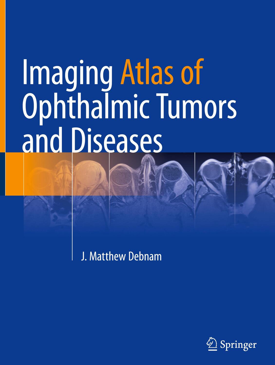 Cover: 9783031174780 | Imaging Atlas of Ophthalmic Tumors and Diseases | J. Matthew Debnam