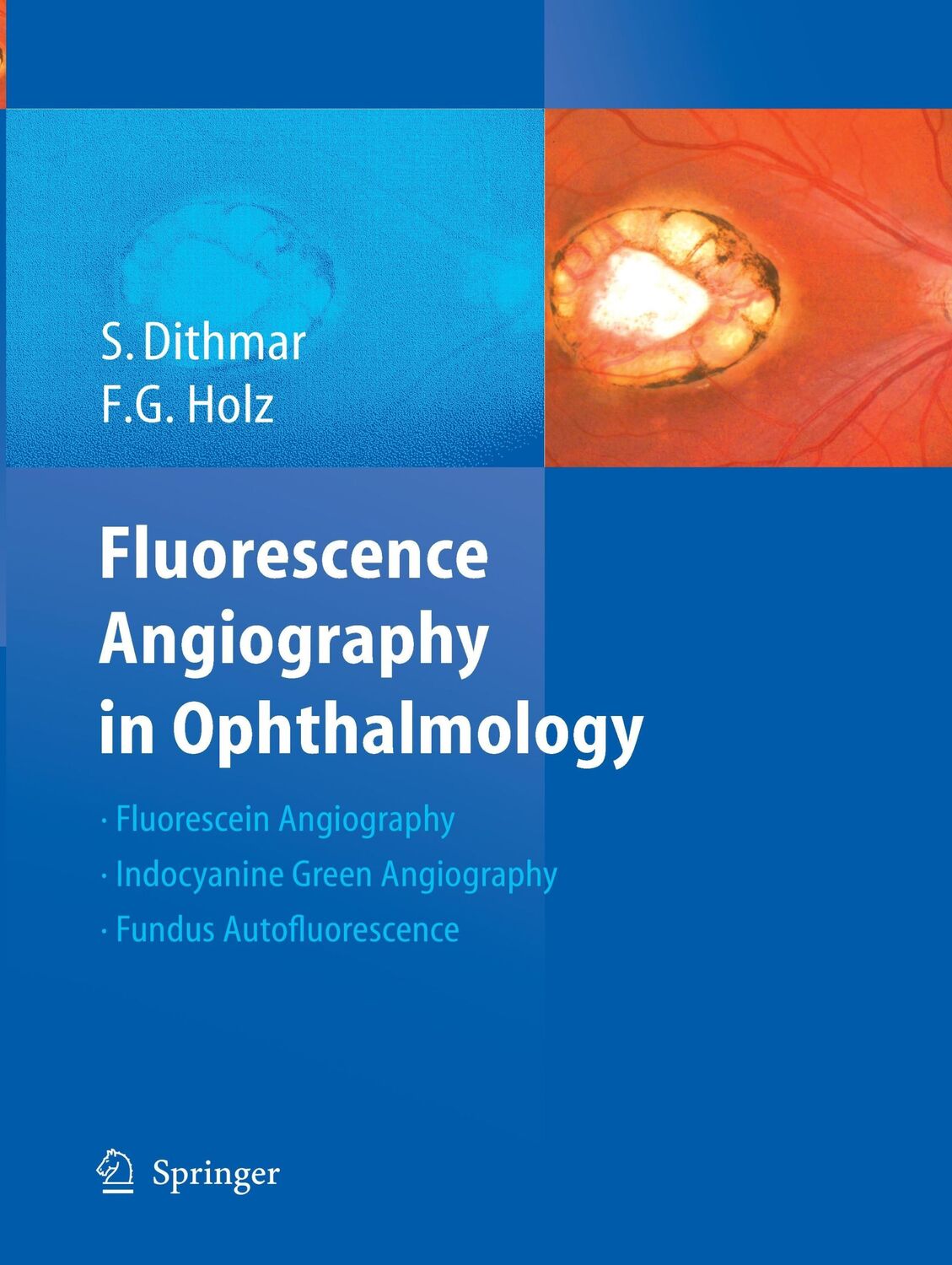 Cover: 9783662517918 | Fluorescence Angiography in Ophthalmology | Frank G. Holz (u. a.) | x