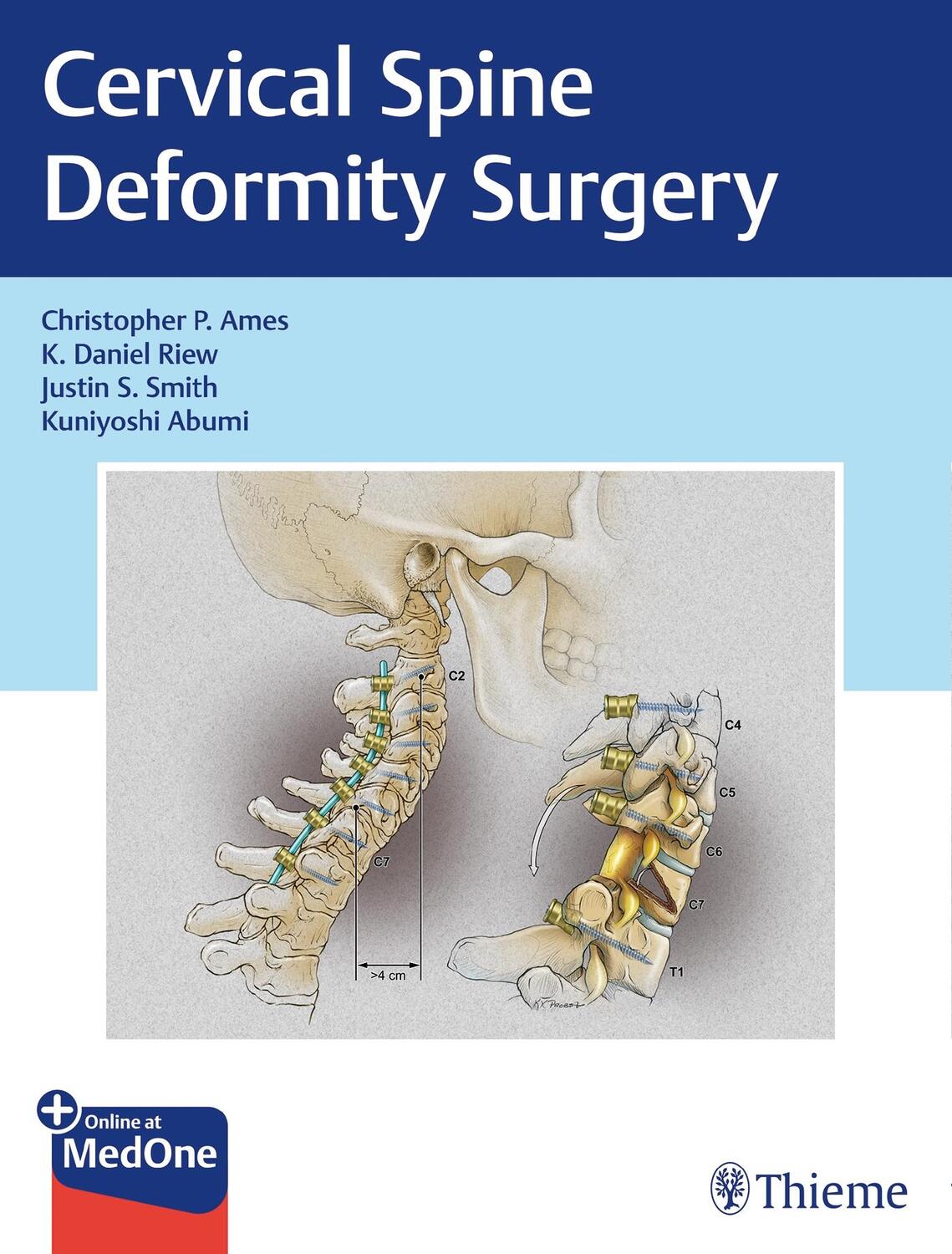Cover: 9781626239012 | Cervical Spine Deformity Surgery | Christopher Ames (u. a.) | Buch