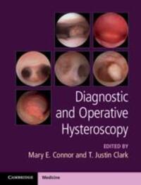 Cover: 9781107111608 | Diagnostic and Operative Hysteroscopy | Mary E Connor (u. a.) | Buch